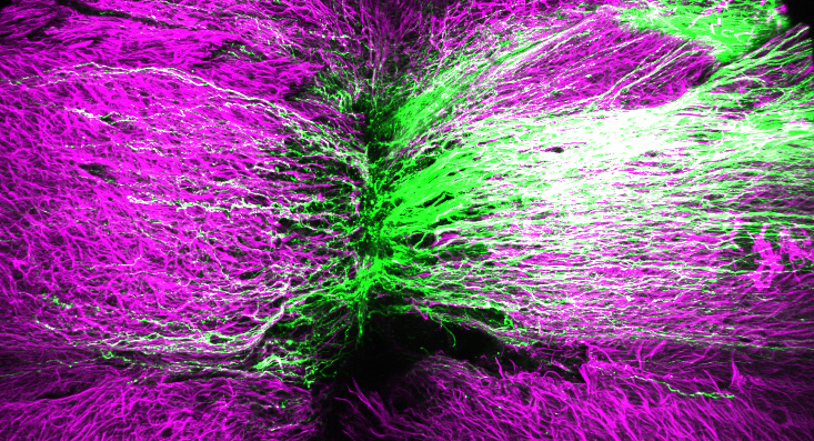 Nerve cell processes (axons) grow from right to left across a spinal cord injury lesion site surrounded by astrocytes